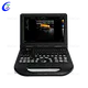 3D Digital Ultrasound